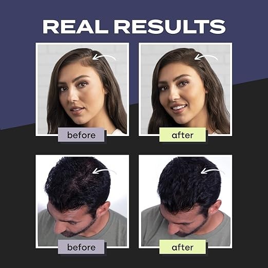 Hair Building Fibers for Thinning Hair - Natural Keratin Concealer