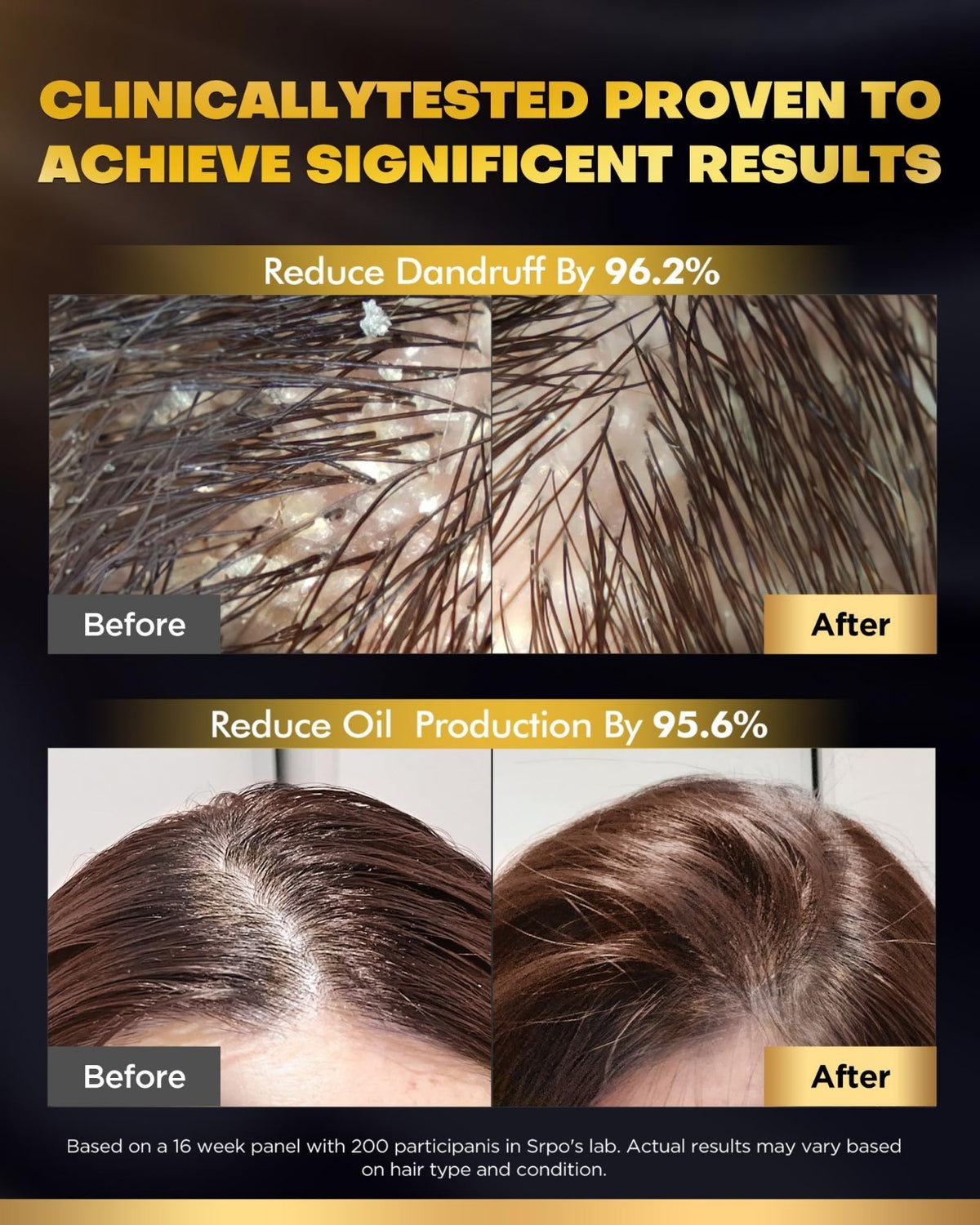 Biotin Hair Growth Shampoo & Conditioner Set for Hair Loss & Volume