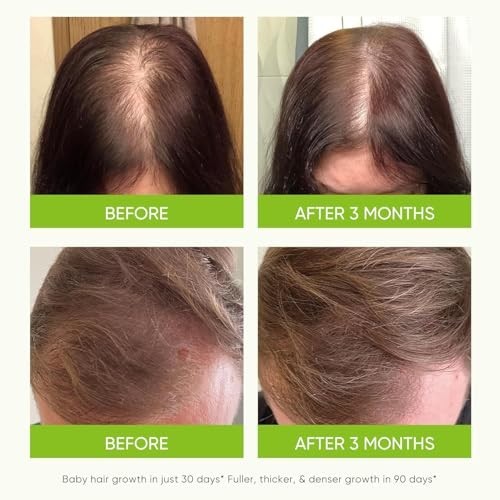 Rosemary Hair Shampoo & Conditioner Set with Volumizing Spray – 3 Piece Hair Care Kit