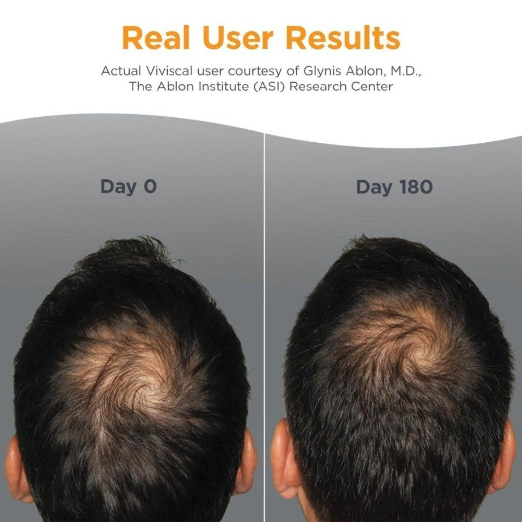 Men's Hair Growth Supplements for Thicker Fuller Hair - 180 Tablets, 1-3 Pack