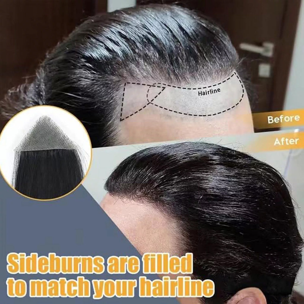 Remy Human Hair Topper Pieces for Bald Spots - Natural Look & Easy to Use