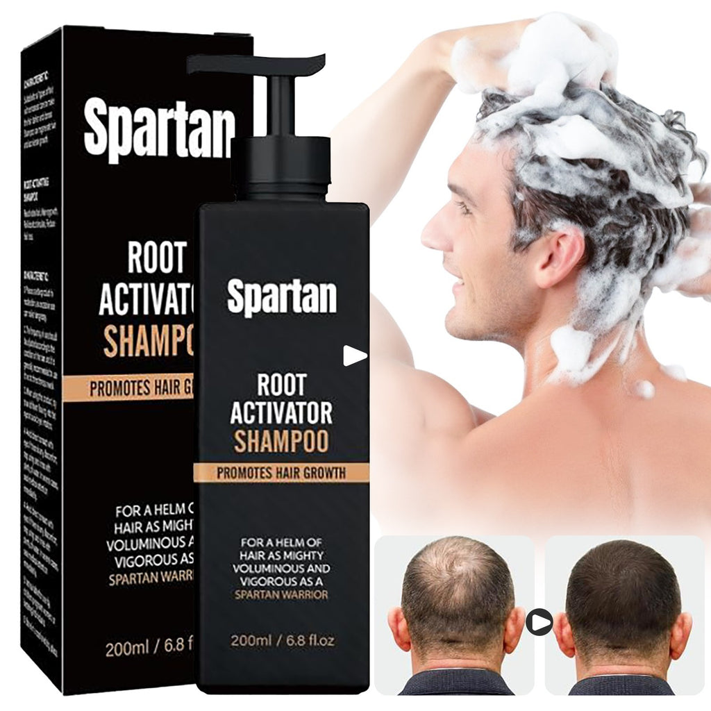 Root Activator Shampoo for Hair Growth - Hair Loss Treatment 200ml
