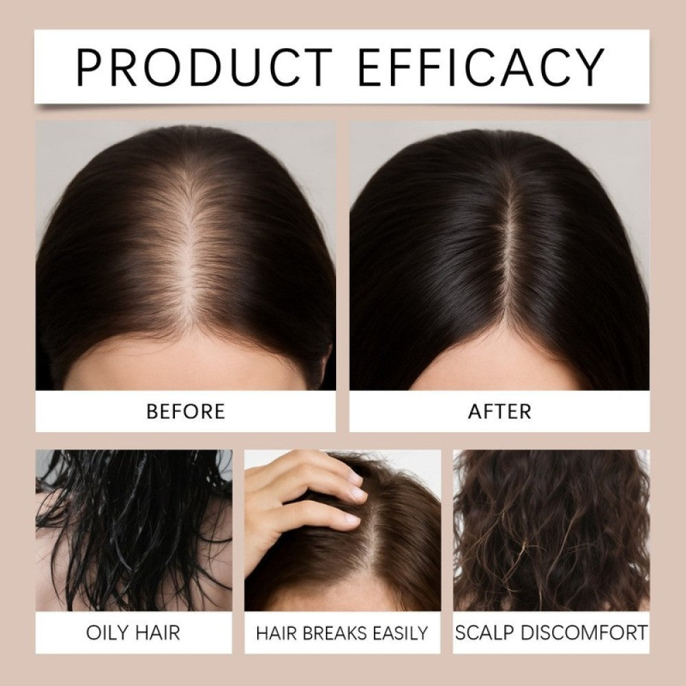 Microneedle Hair Regrowth System for Thicker Hair - Advanced Treatment Kit