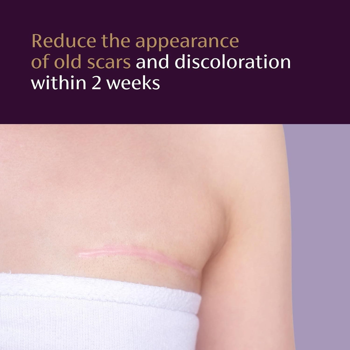 Scar Serum with Vitamin E Hyaluronic Acid & Niacinamide - Fades Old Scars