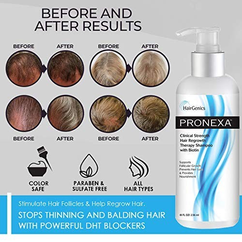 Clinical Strength Hair Growth Shampoo with Biotin Collagen DHT Blockers 8 oz