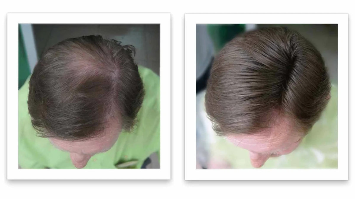 Hair Fibers 30g Bottle - Natural Plant-Based Hair Loss Concealer