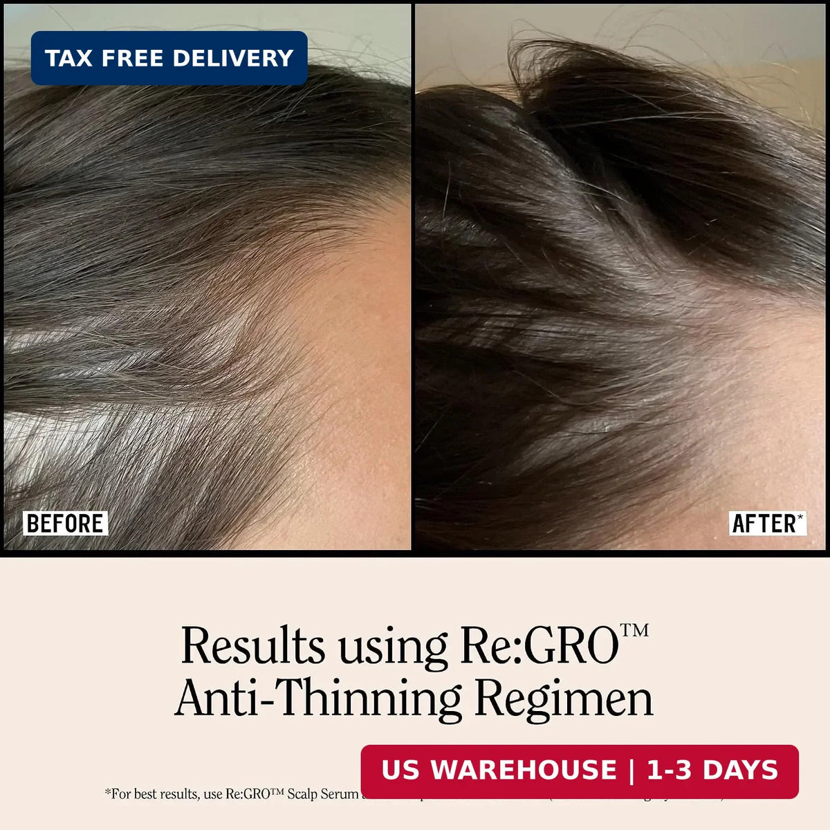 Men's Hair Growth Serum with Capixyl & Biotin - Thicker, Fuller Hair Support