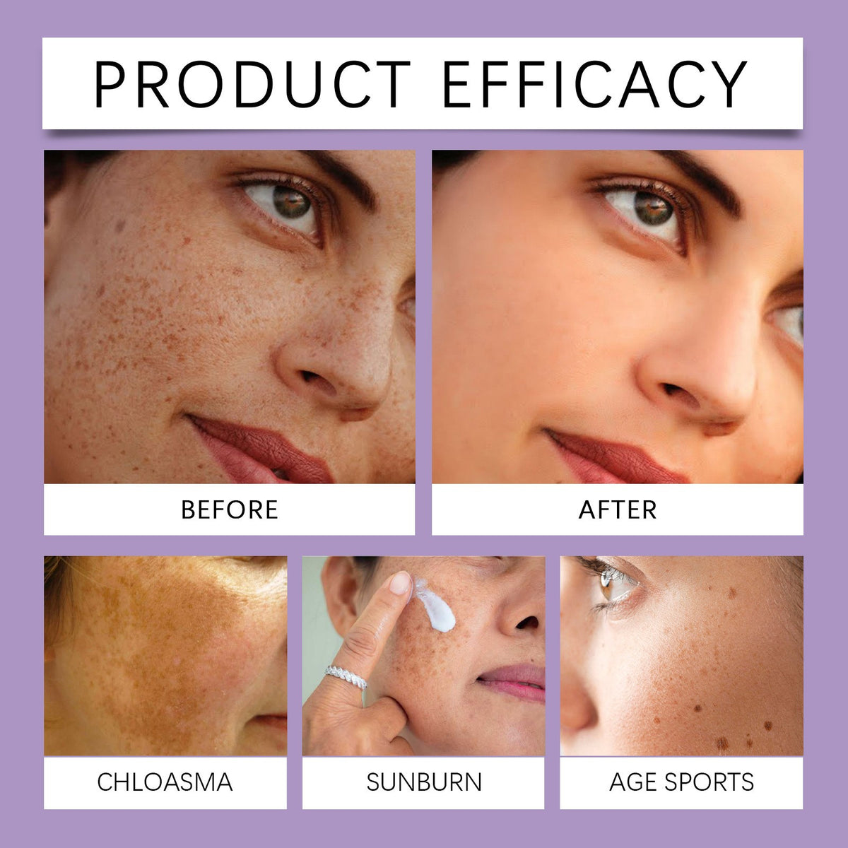 Anti-Hyperpigmentation Cream with Retinol for Sensitive Skin - 30g