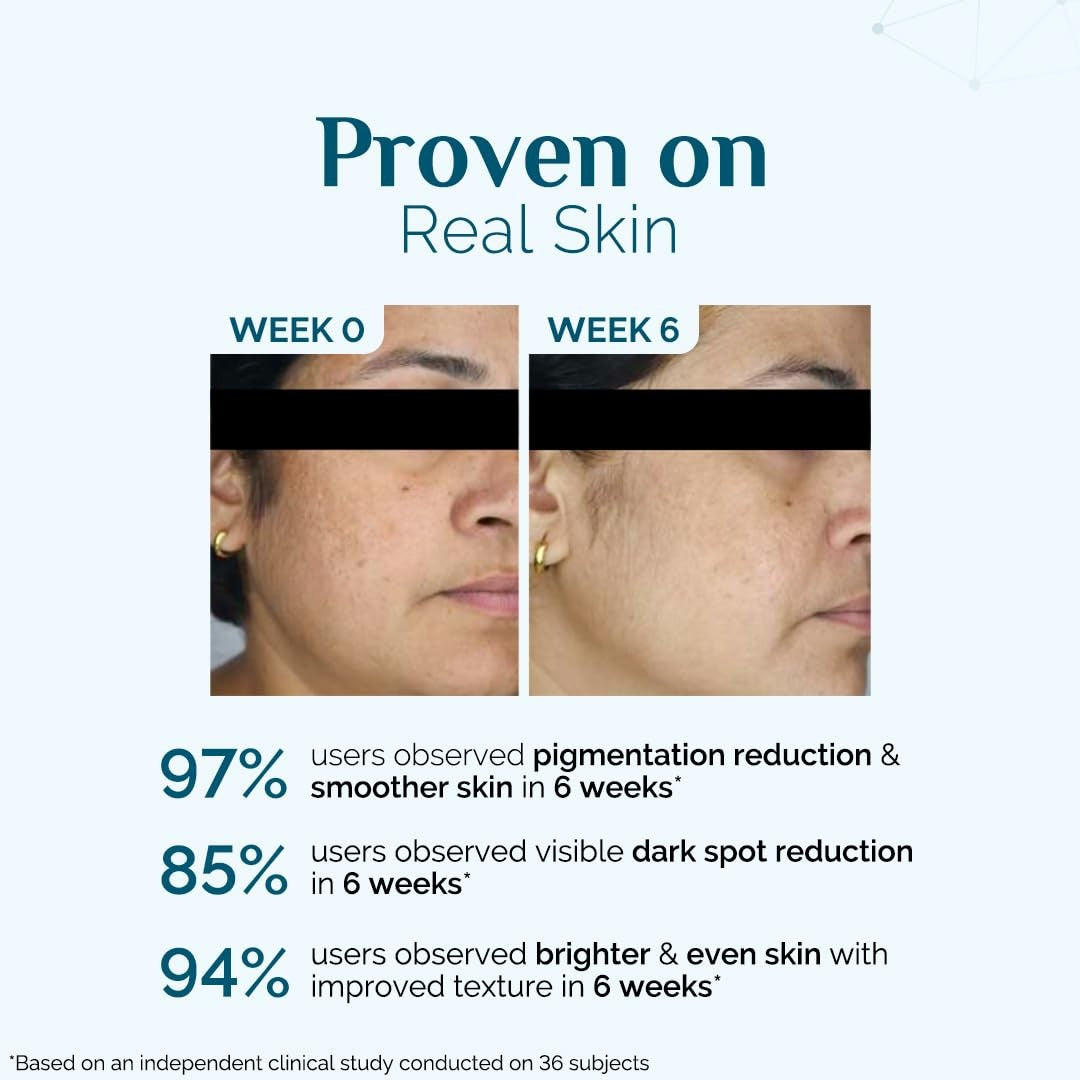 Peptide Skin Serum for Dark Spot Reduction & Skin Tone Evenness - 30ml