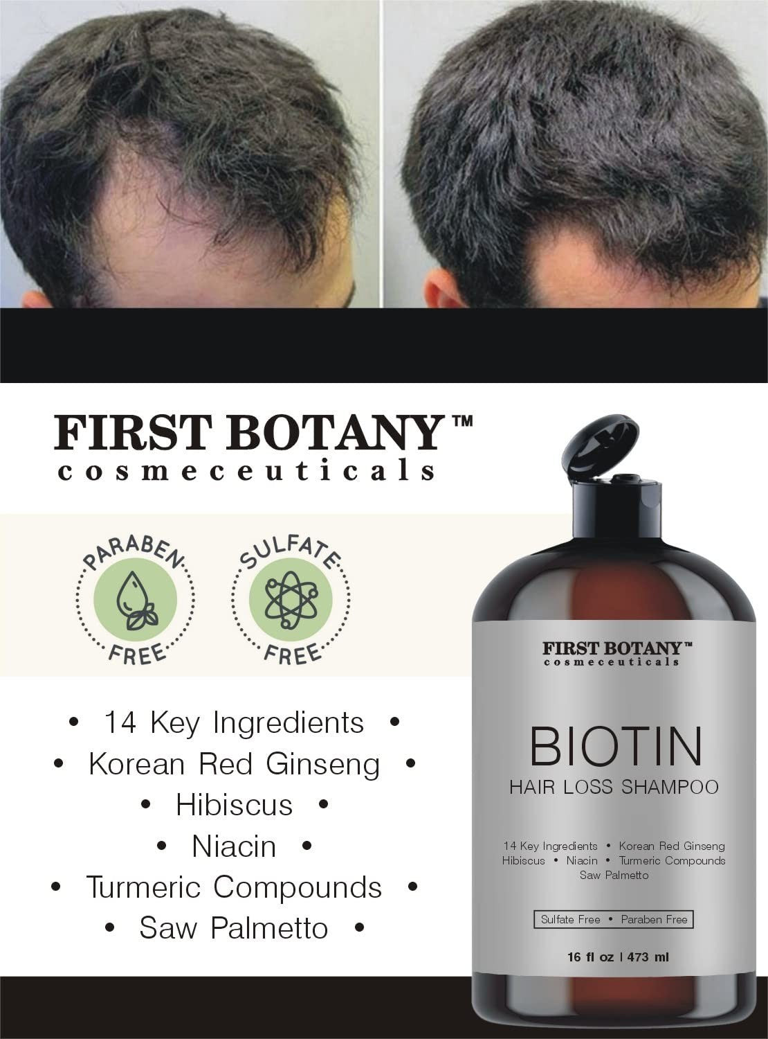 Natural DHT Blocker Shampoo for Hair Loss - Herbal Hair Growth Treatment, 16 oz