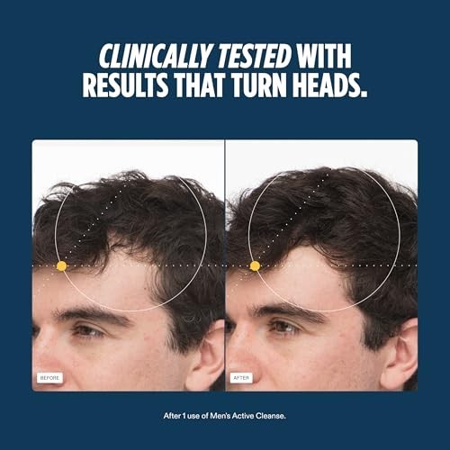 Men's 2-in-1 Shampoo & Conditioner for Thinning Hair - 8.1 Fl Oz