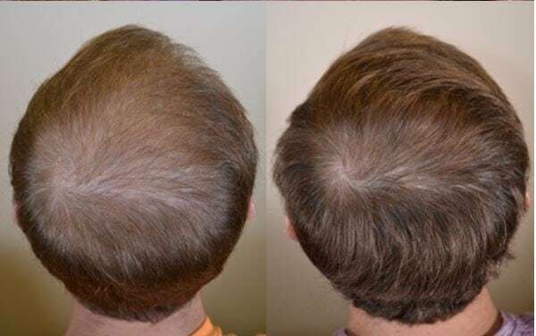 Hair Loss Regrowth Shampoo & Conditioner Set with 16 Natural Oils for Men Women