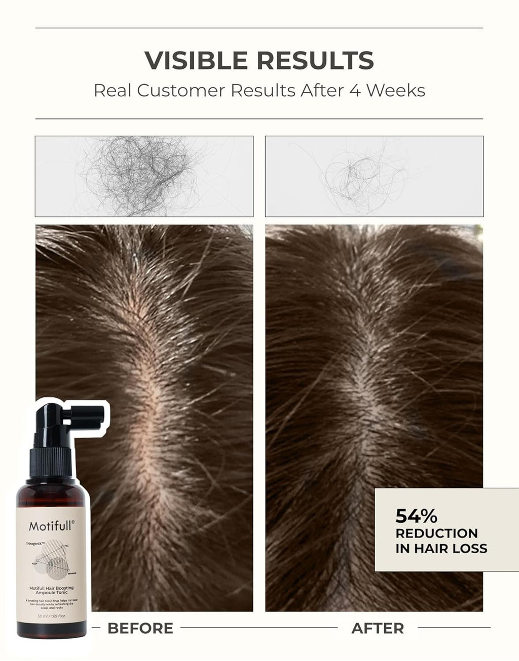 Korean Hair Loss Shampoo & Treatment Set for Thinning Hair - Scalp Care, Biotin & Caffeine