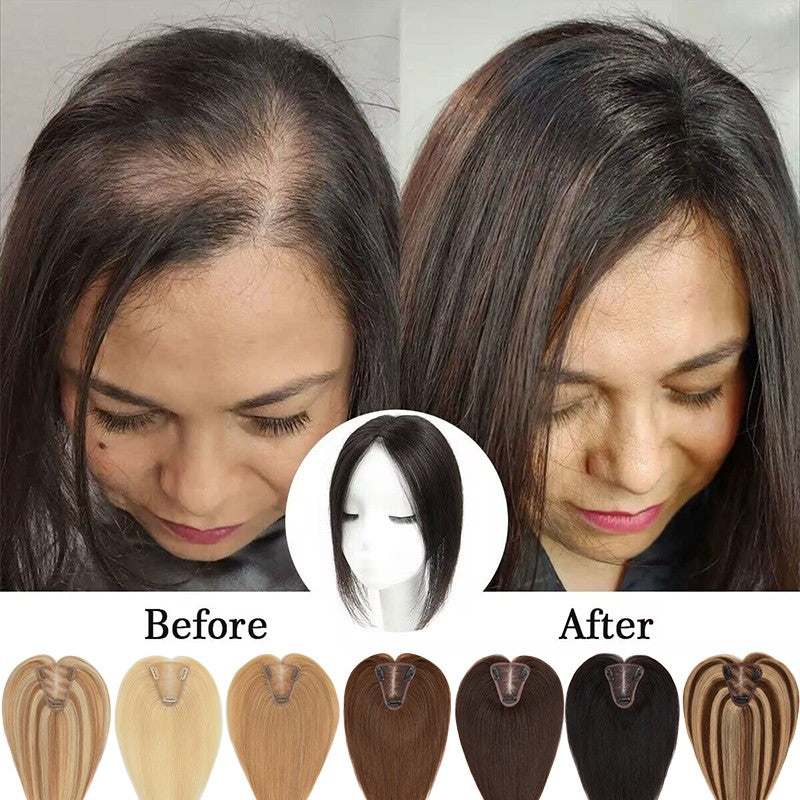 Clip-In Remy Human Hair Topper for Women - Natural & Colored Options