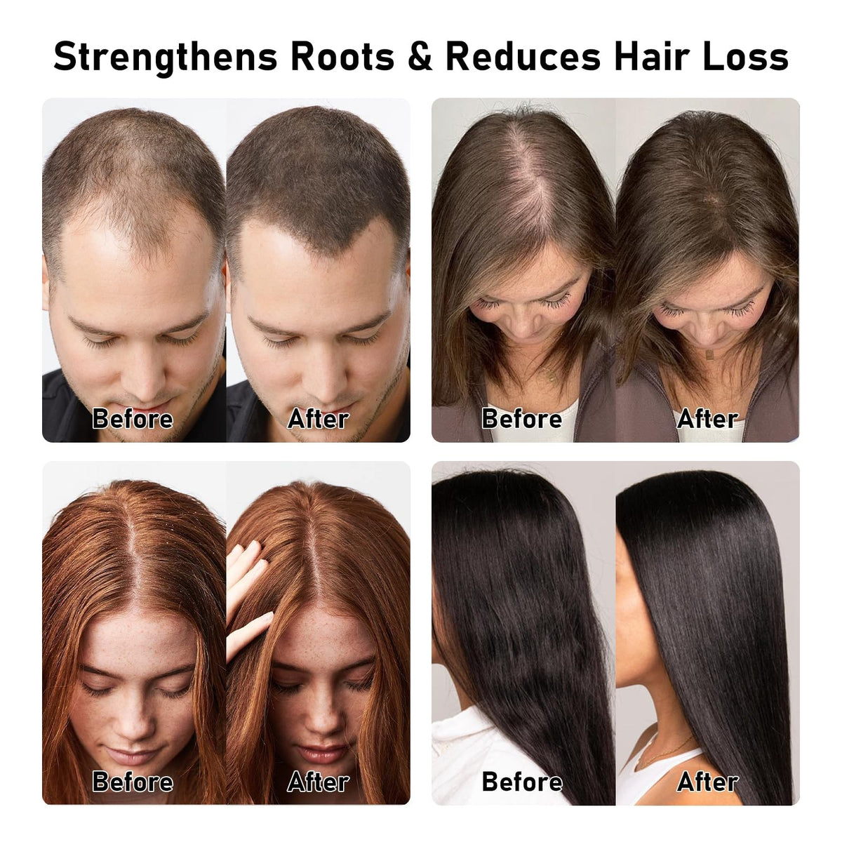 Rosemary Batana Shampoo for Thinning Hair with Biotin & Keratin – Gentle Volumizing 11.8 Fl Oz