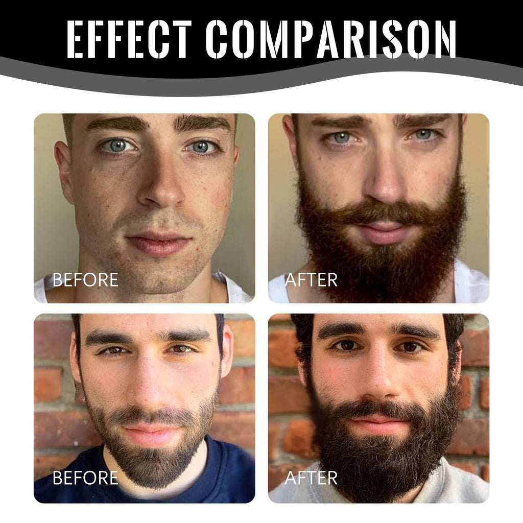 Men's Beard Growth Balm - Stimulating Moisturizer & Nourisher 100g