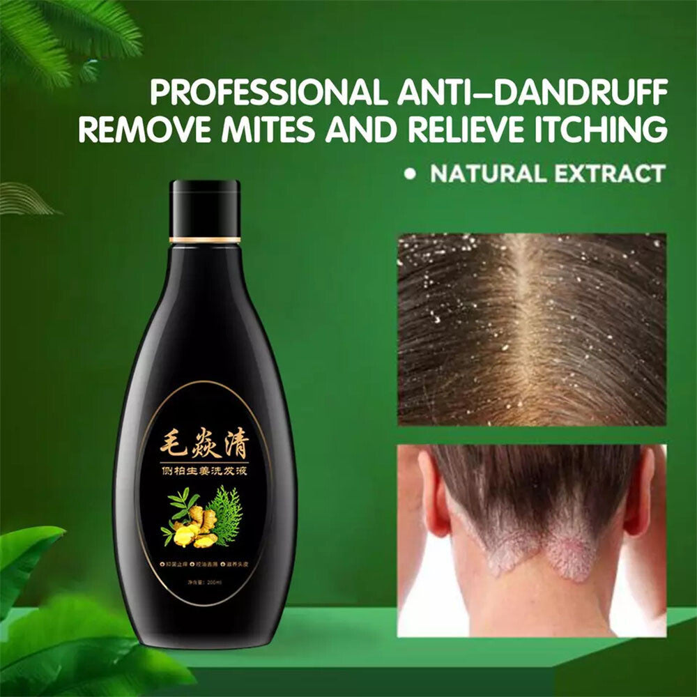Natural Scalp & Hair Follicle Shampoo for Dandruff Itching Oil Control 200ml