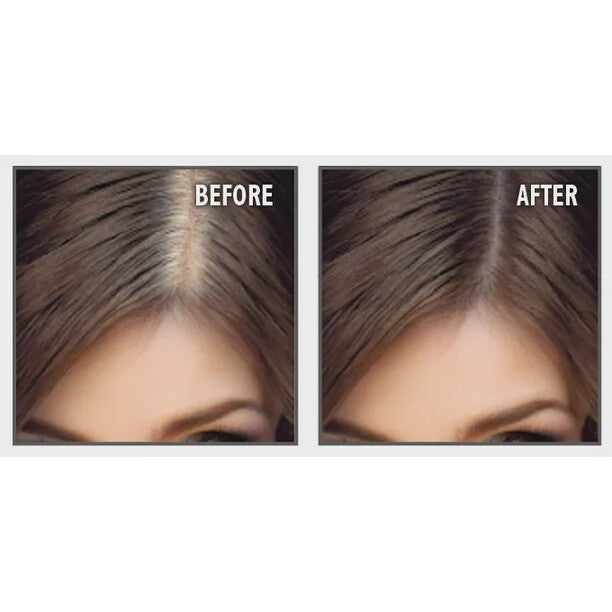 Hair Color Tint Kit for Gray Coverage — Up to 6 Weeks, 20 Applications