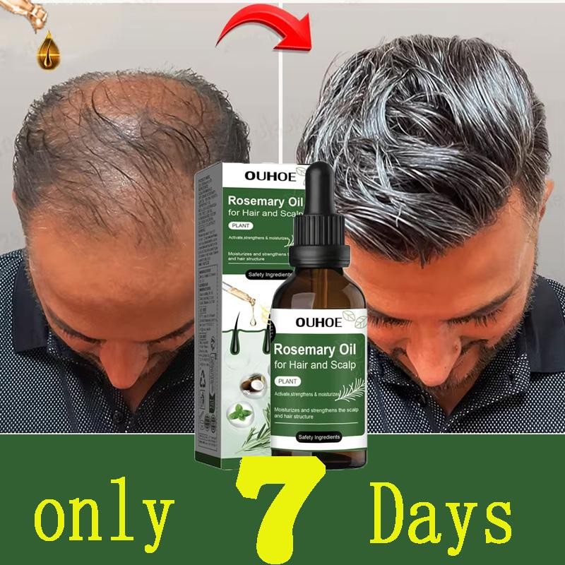 Hair Growth Oil for Hair Loss & Regrowth - Nourishing Rosemary Treatment 50ml