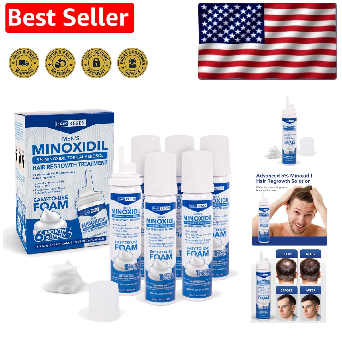 Men's 5% Minoxidil Foam Hair Regrowth Treatment for Thinning Hair