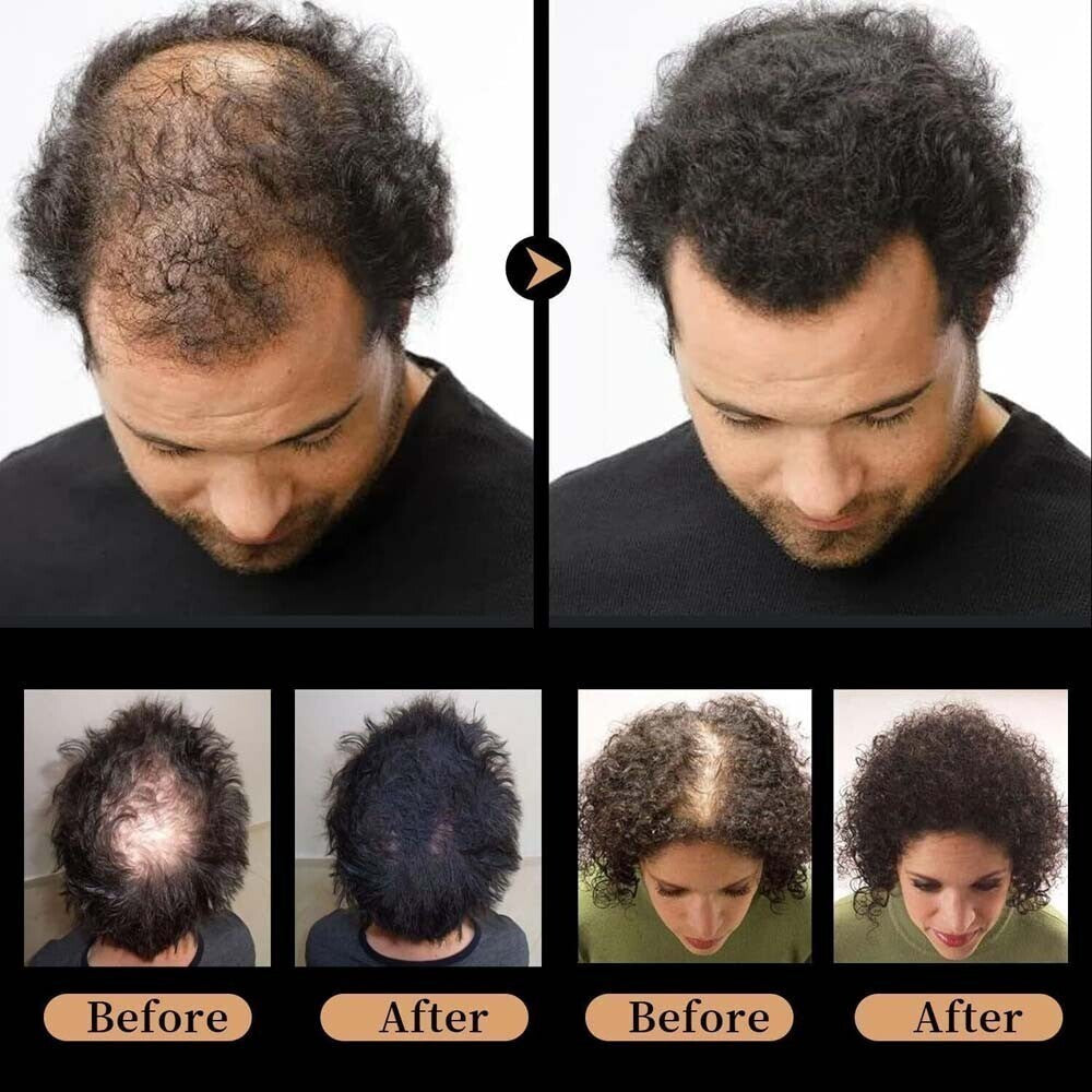 Root Activator Hair Loss Shampoo for Thicker Fuller Hair - 6 Pack