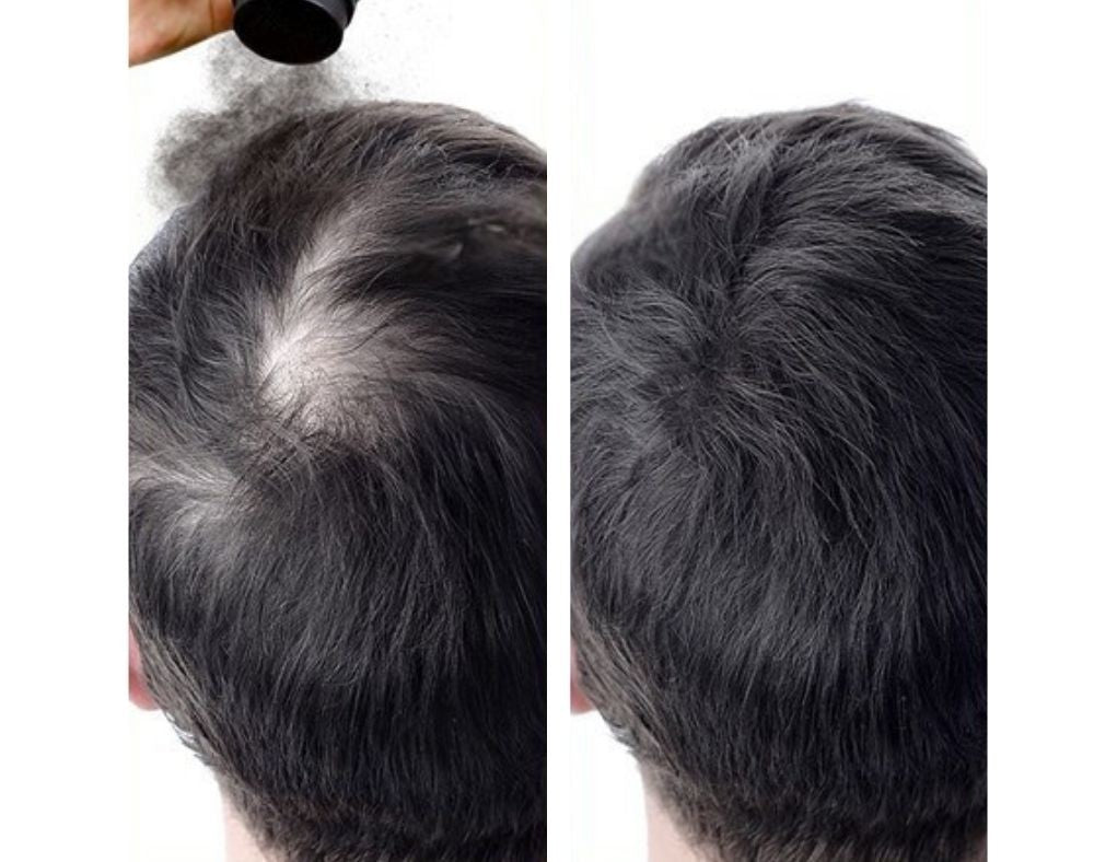 Hair Building Fibers for Thinning Hair | Instant Volume & Concealment