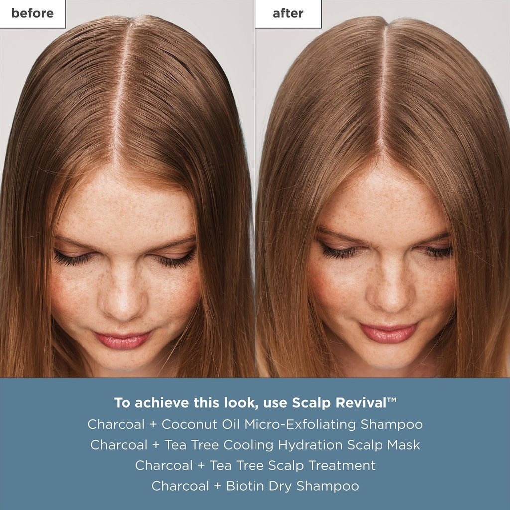 Scalp Treatment Serum with Charcoal and Tea Tree for Hair Care - Leave-In