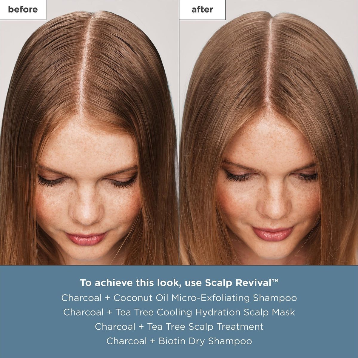 Scalp Treatment Serum with Charcoal and Tea Tree for Hair Care - Leave-In
