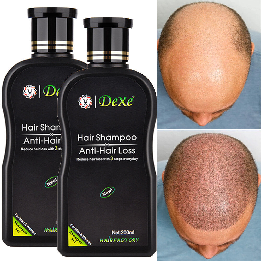 Anti-Hair Loss Shampoo for Men & Women - Herbal Hair Regrowth 200ml
