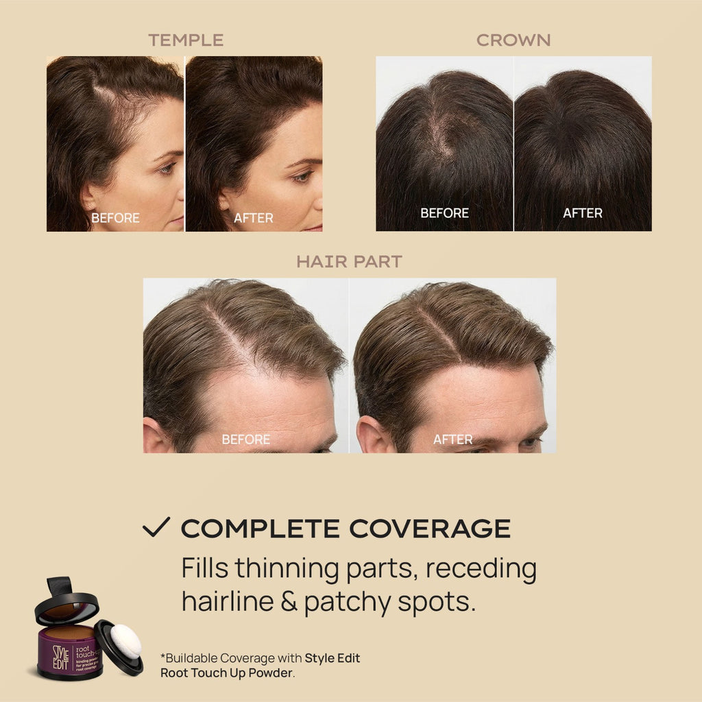 Hair Building Fibers for Thinning Hair | Instant Volume & Concealment