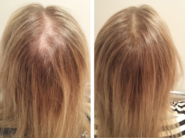 Hair Loss Regrowth Shampoo & Conditioner Set with 16 Natural Oils for Men Women