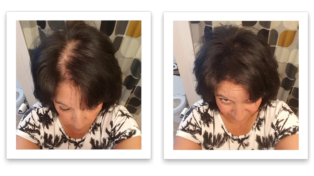 Hair Fibers 30g Bottle - Natural Plant-Based Hair Loss Concealer