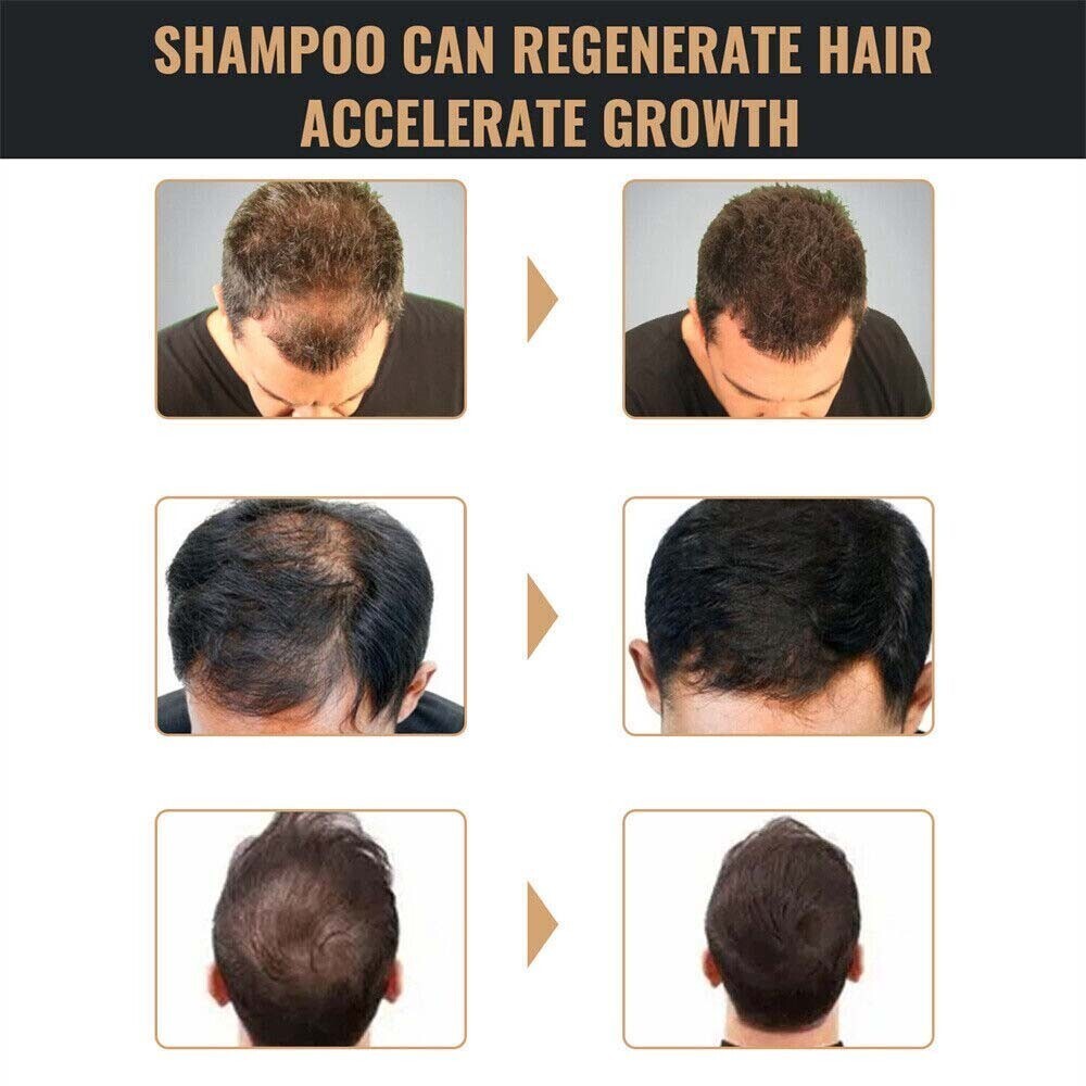 Root Activator Hair Loss Shampoo for Thicker Fuller Hair - 6 Pack