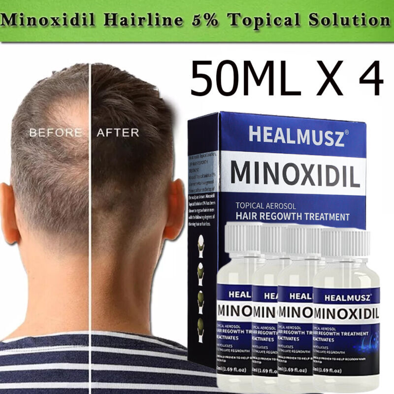 Men's Hair Regrowth Treatment with Minoxidil 5% - 4 Pack, 4 Month Supply