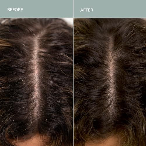 Detox Clarifying Shampoo & Salt Scalp Scrub - Sulfate-Free Deep Cleanse for All Hair Types