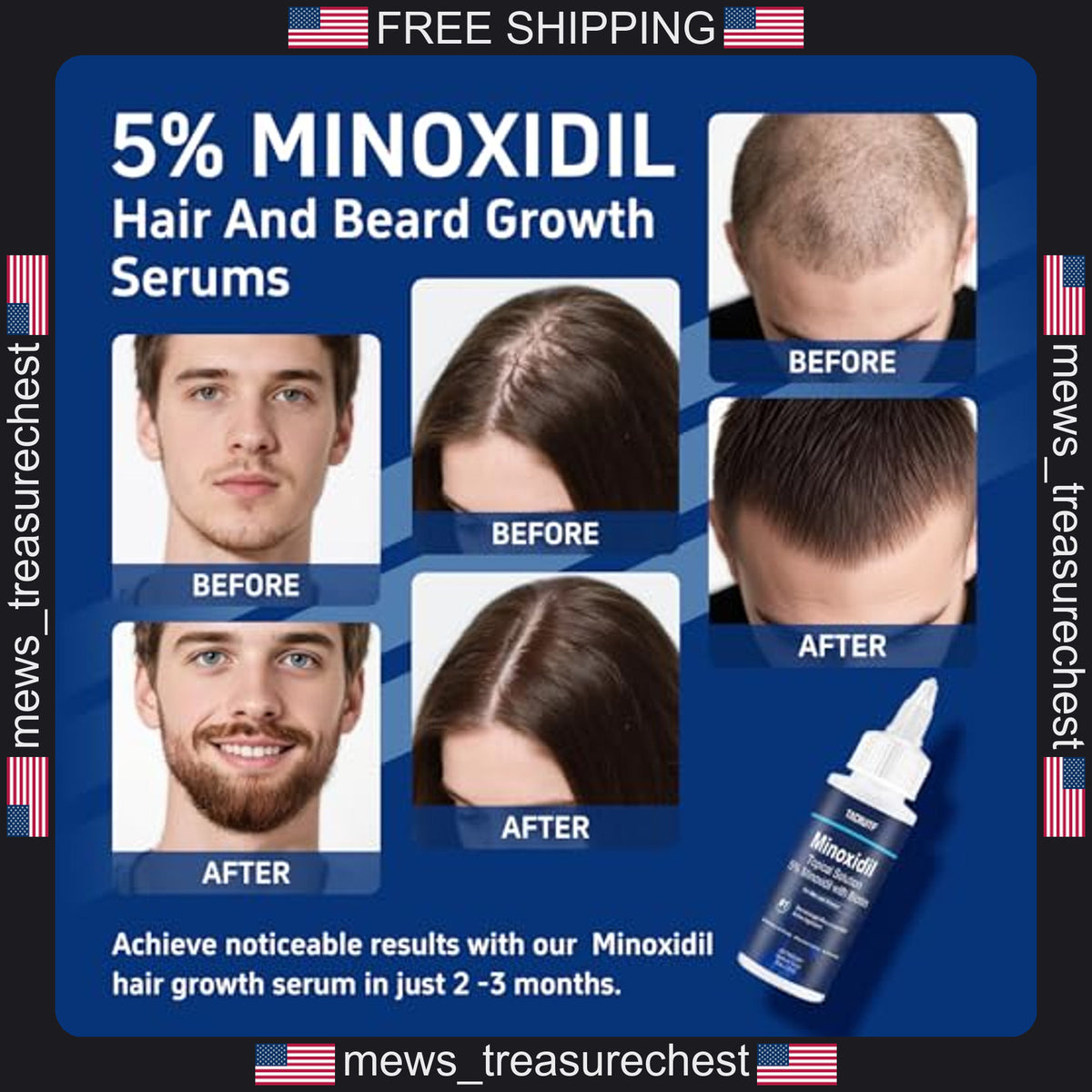 Minoxidil Hair Growth Treatment 5% with Biotin & Castor Oil - 6 Pack, 12 fl oz