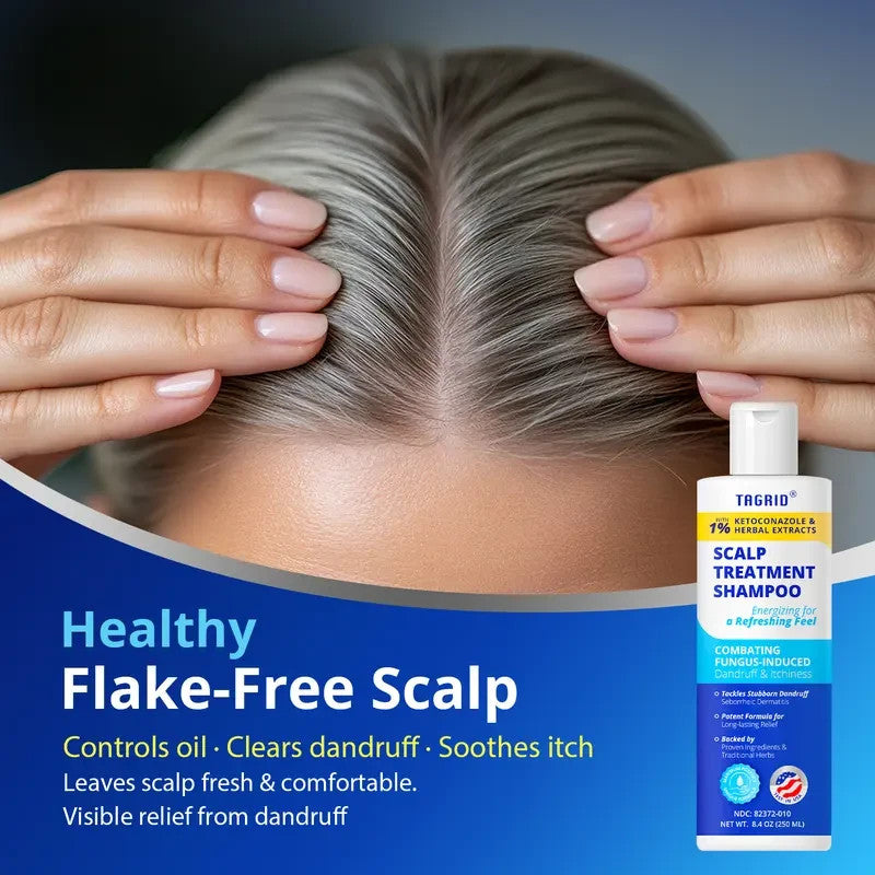 Herbal Antifungal Shampoo for Dandruff Oily Scalp - Ketoconazole & Herbal Extracts