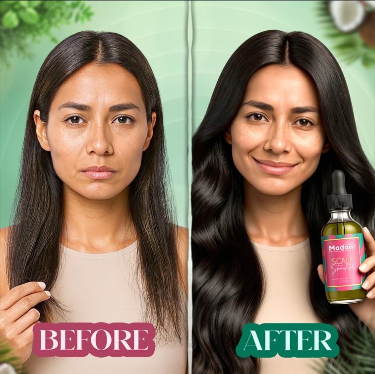 Scalp Stimulator Hair Growth Oil with Rosemary & Mint - Hair Loss Treatment for All Hair Types