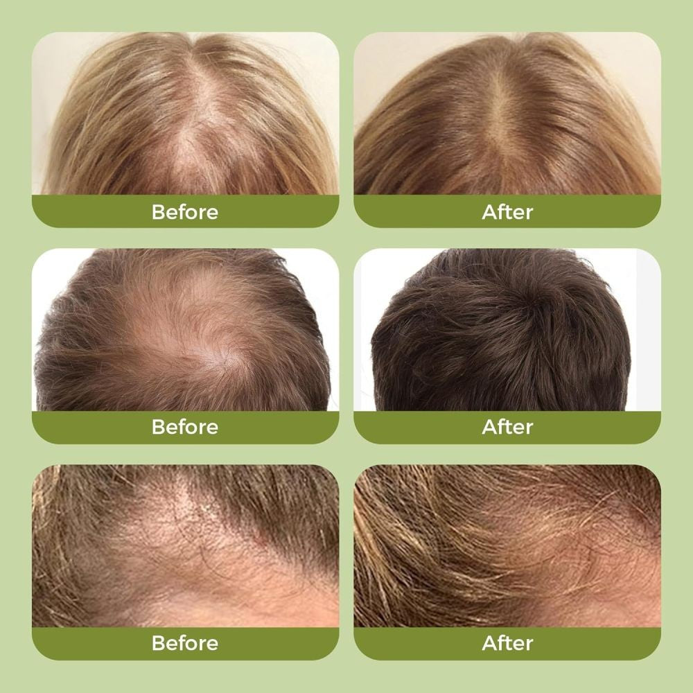 Organic Rosemary Hair Growth Shampoo for Thicker, Stronger Hair - 2 Pack