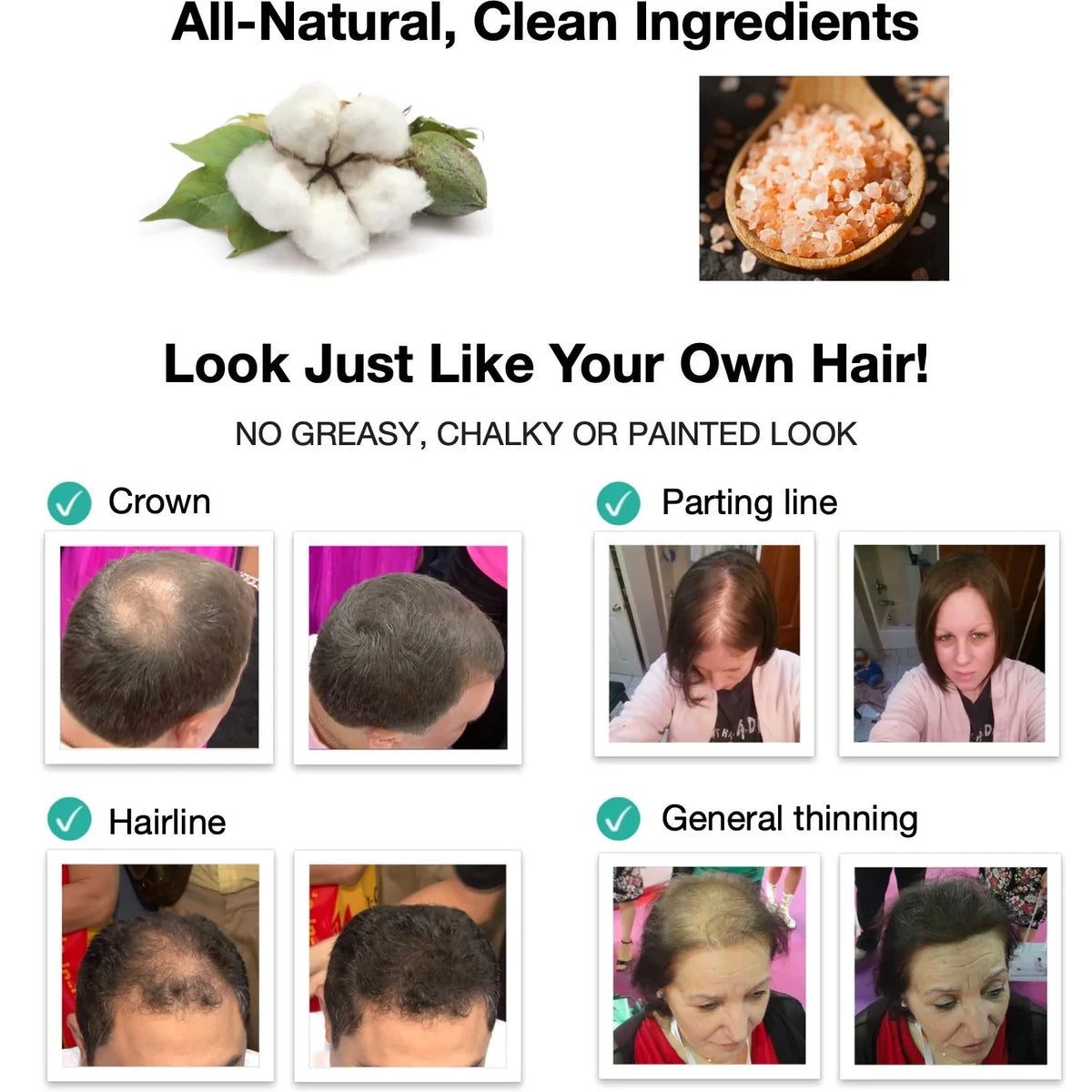 Hair Fibers 30g Bottle - Natural Plant-Based Hair Loss Concealer