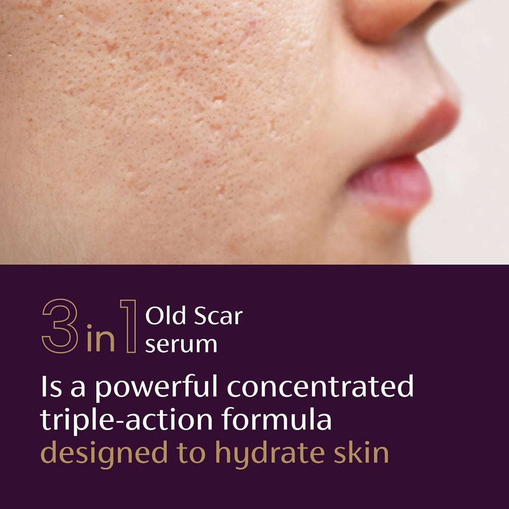 Scar Serum with Vitamin E Hyaluronic Acid & Niacinamide - Fades Old Scars