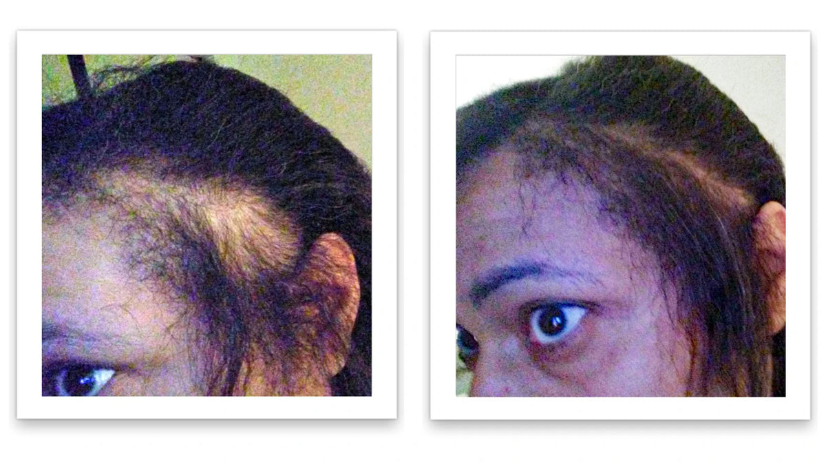 Hair Fibers 30g Bottle - Natural Plant-Based Hair Loss Concealer