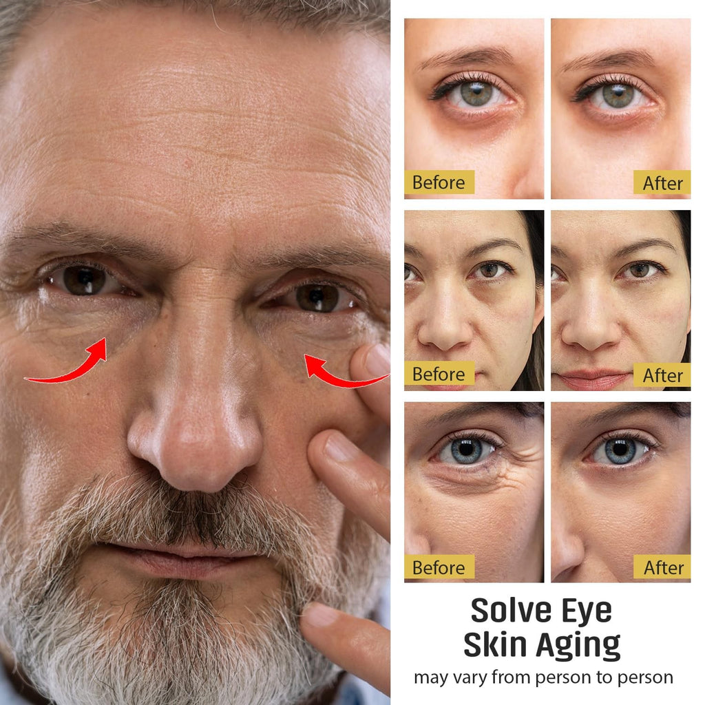 Eye Serum for Dark Circles Puffiness Wrinkles - 20ml Hydrating & Firming