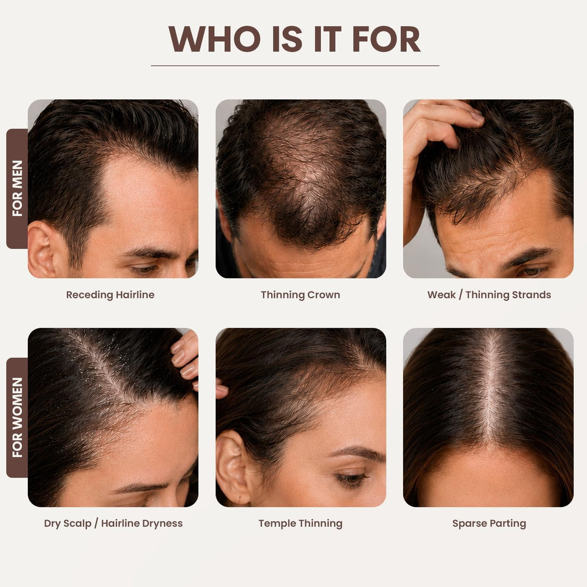 Micro Infusion Hair Treatment Kit for Thinning Hair - 2 Month Supply