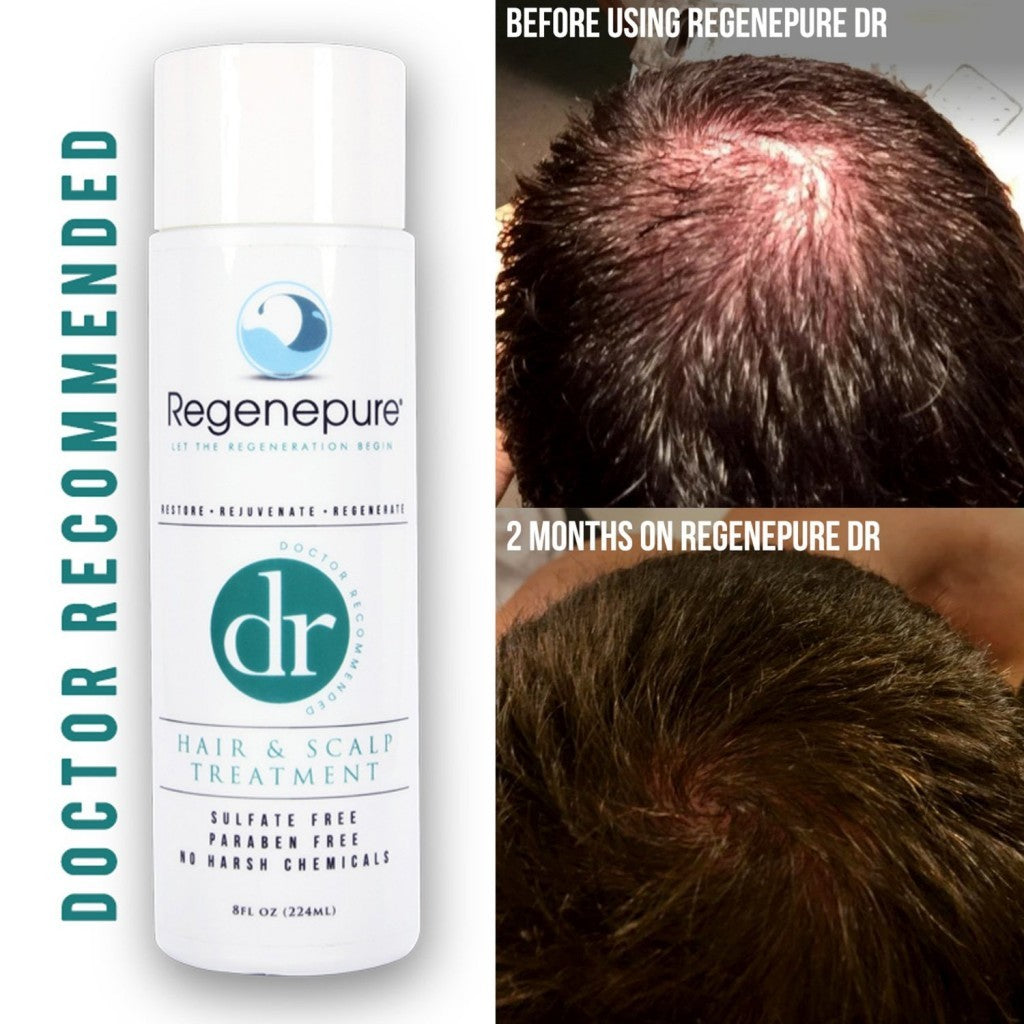 Regenepure DR Hair & Scalp Treatment - DHT Removal, Nourishing & Sulfate-Free, 8 Oz
