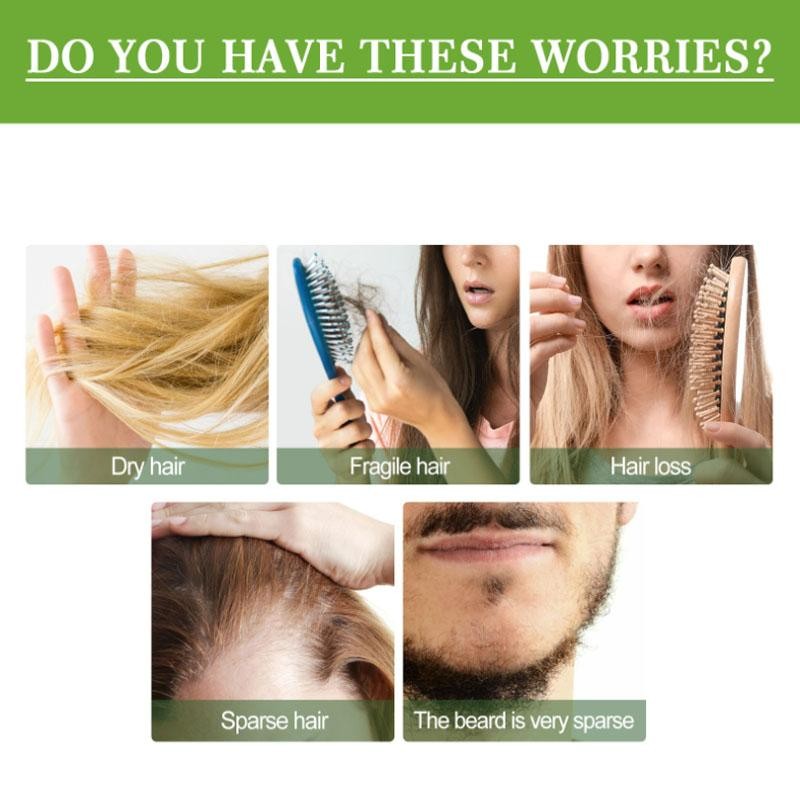 Hair Growth Oil for Hair Loss & Regrowth - Nourishing Rosemary Treatment 50ml