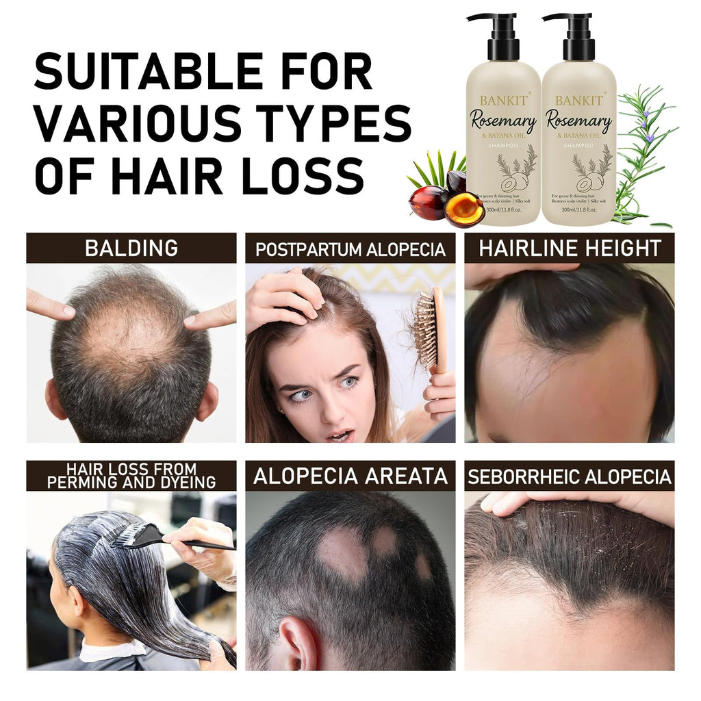 Rosemary Batana Shampoo for Thinning Hair with Biotin & Keratin – Gentle Volumizing 11.8 Fl Oz