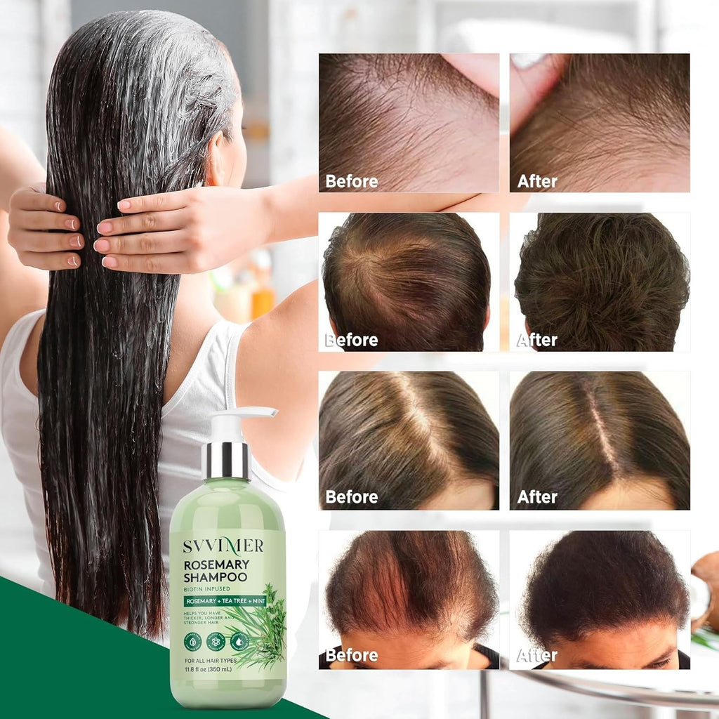 Hair Growth Shampoo with Biotin and Collagen for Thicker, Healthier Hair