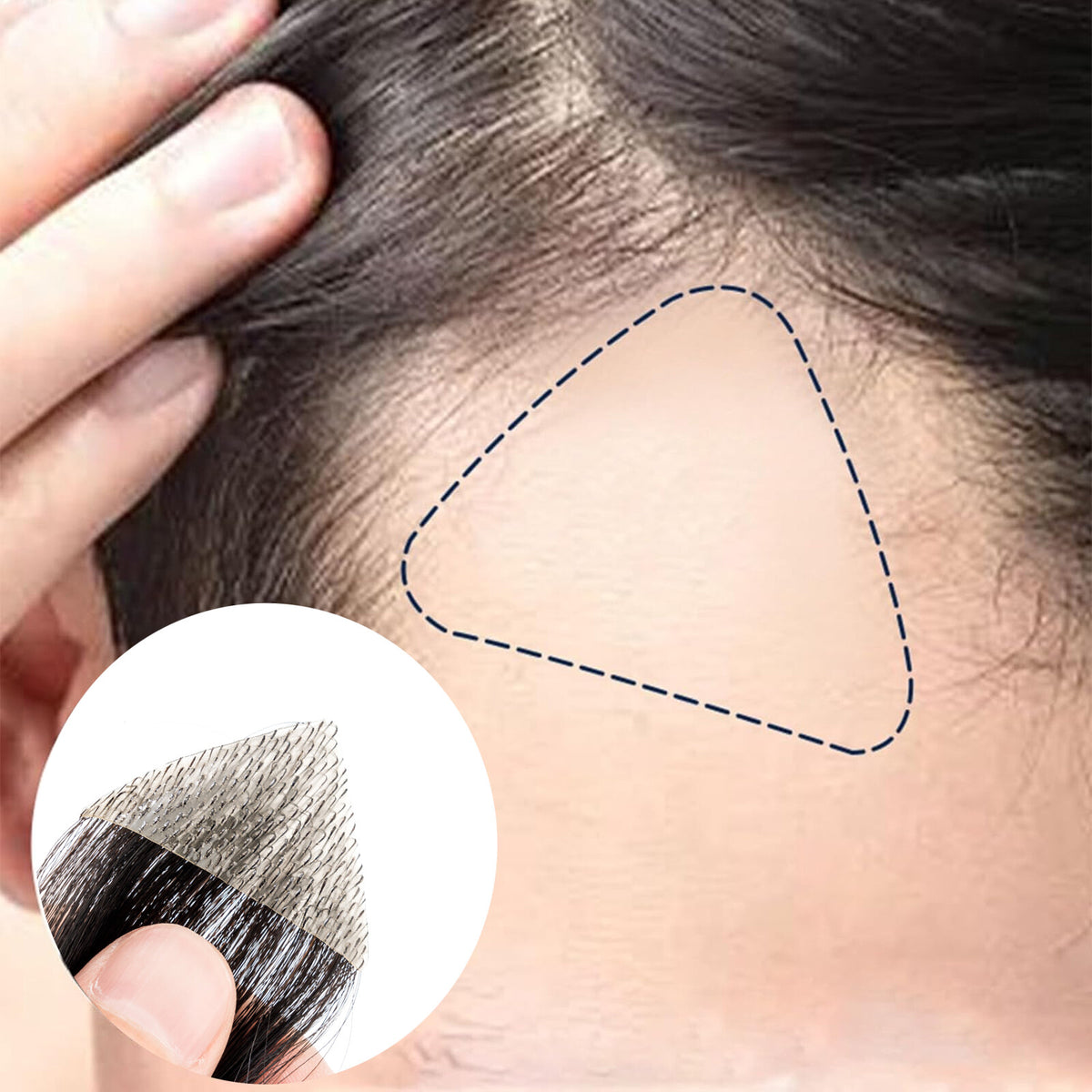 Remy Human Hair Topper Pieces for Bald Spots - Natural Look & Easy to Use