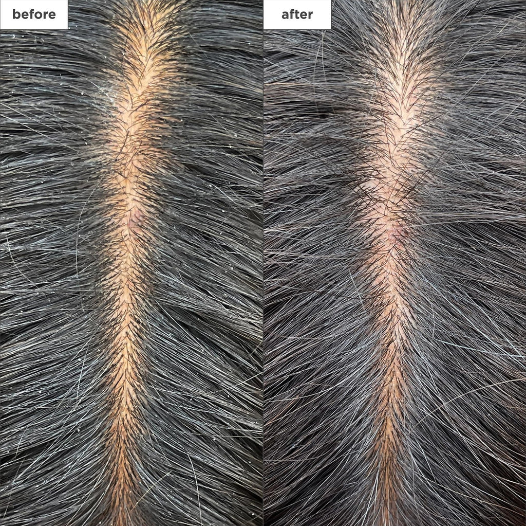 Cooling Scalp Mask with Charcoal & Tea Tree for Hydration & Relief – Vegan & Natural